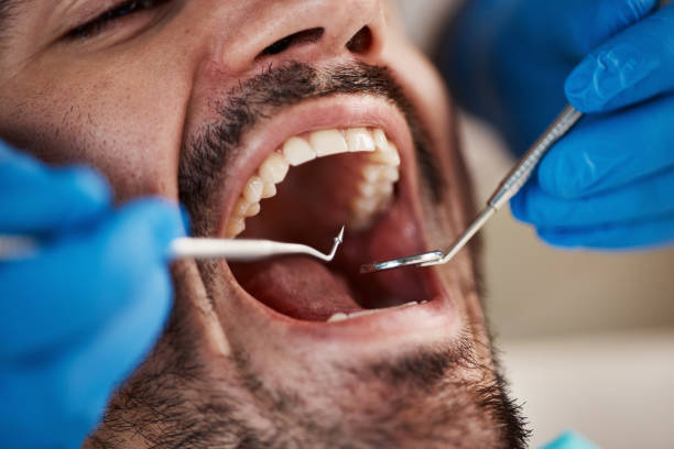 Best Emergency Treatment for Jaw Pain or Injury in Wesley Chapel, FL