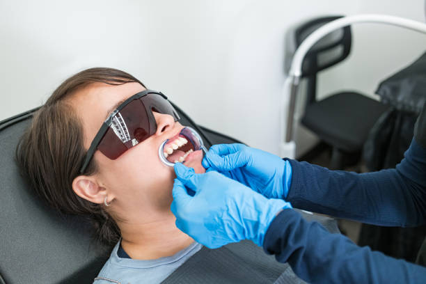 Best Knocked-Out Tooth (Avulsed Tooth) Treatment in Wesley Chapel, FL